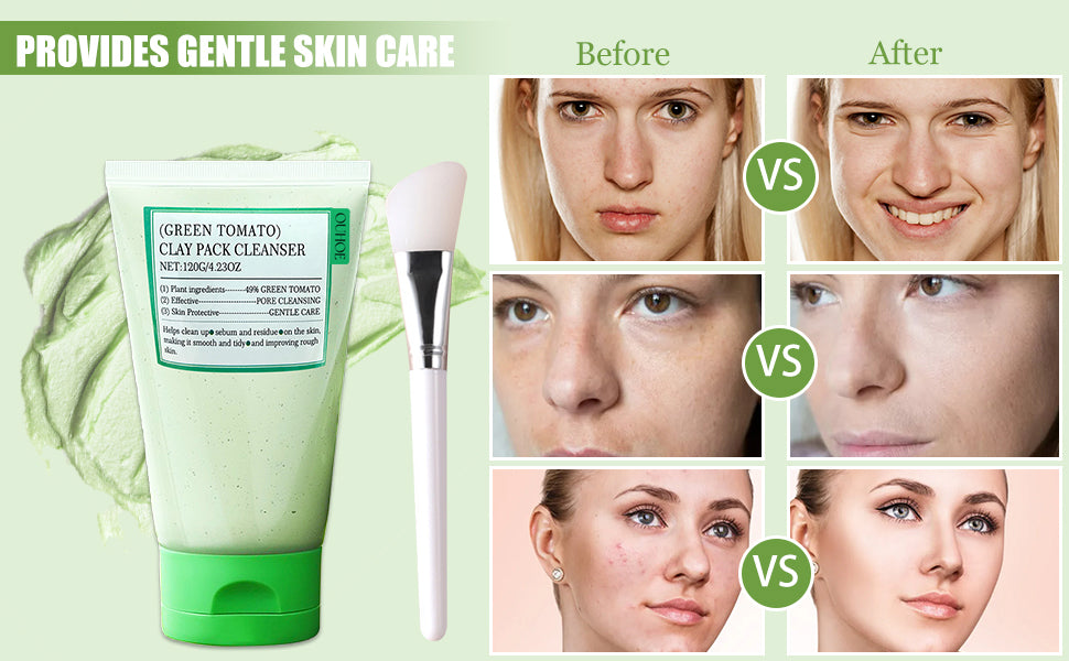 MASCARILLA FACIAL DETOX LIMPIADORA DE POROS, REMOVEDORA DE PUNTOS NEGROS, CONTROL DE GRASA Y ELIMINA IMPUREZAS
